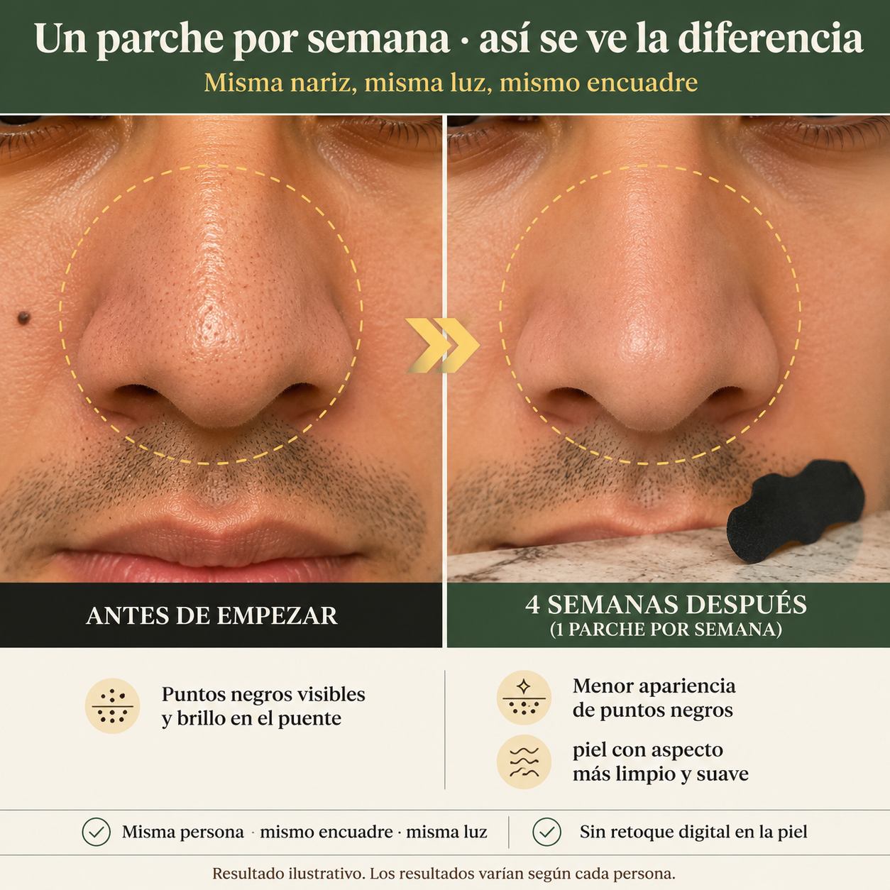 Parche Carbono Activado Puntos Negros - 143114 — vista 5
