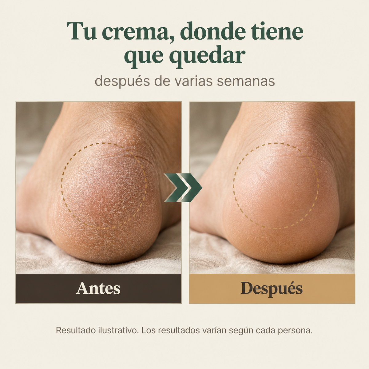 Plantillas De Silicona - 12211 — vista 5