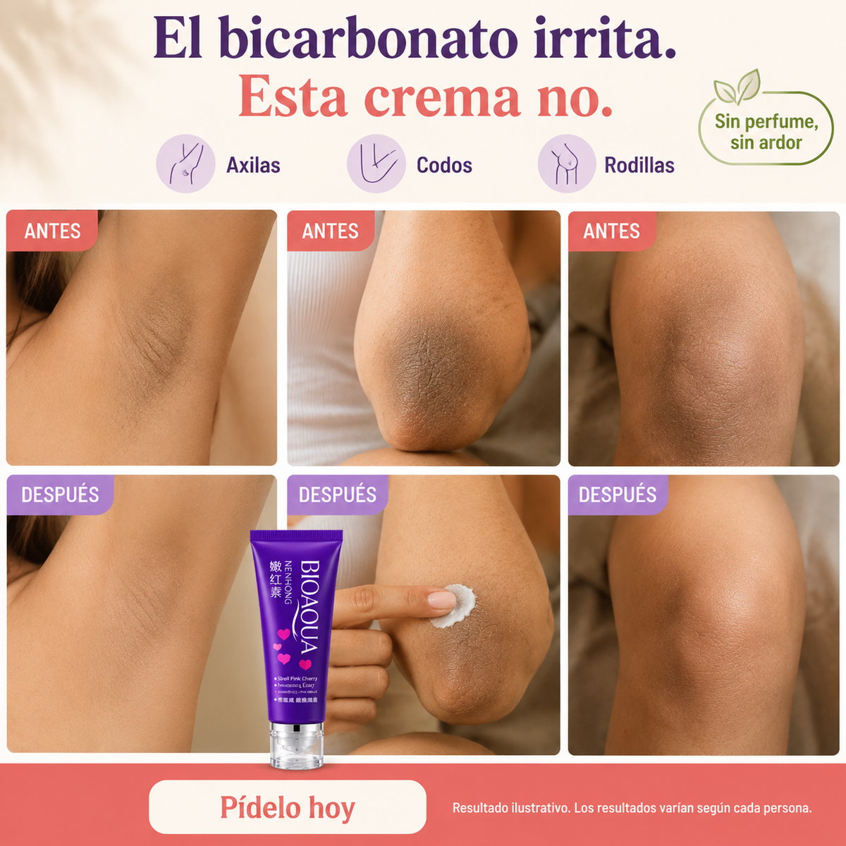 ACLARANTE BIOACQUA - 20862 — vista 2