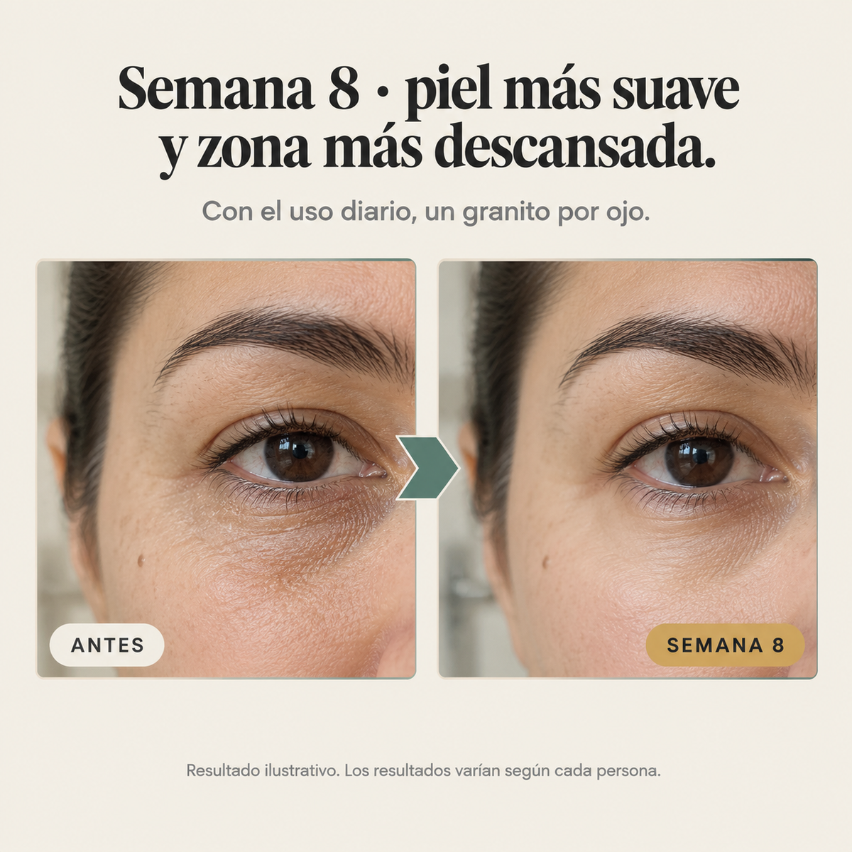 Retinal Shot Contorno De Ojos 15 Ml - 15417 — vista 5